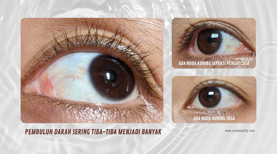 Mataku 1